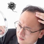 「はげ＝人生終了」は間違い！薄毛から逆転できる現実的な方法とは？